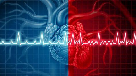 arritmia cardiaca y su tratamiento